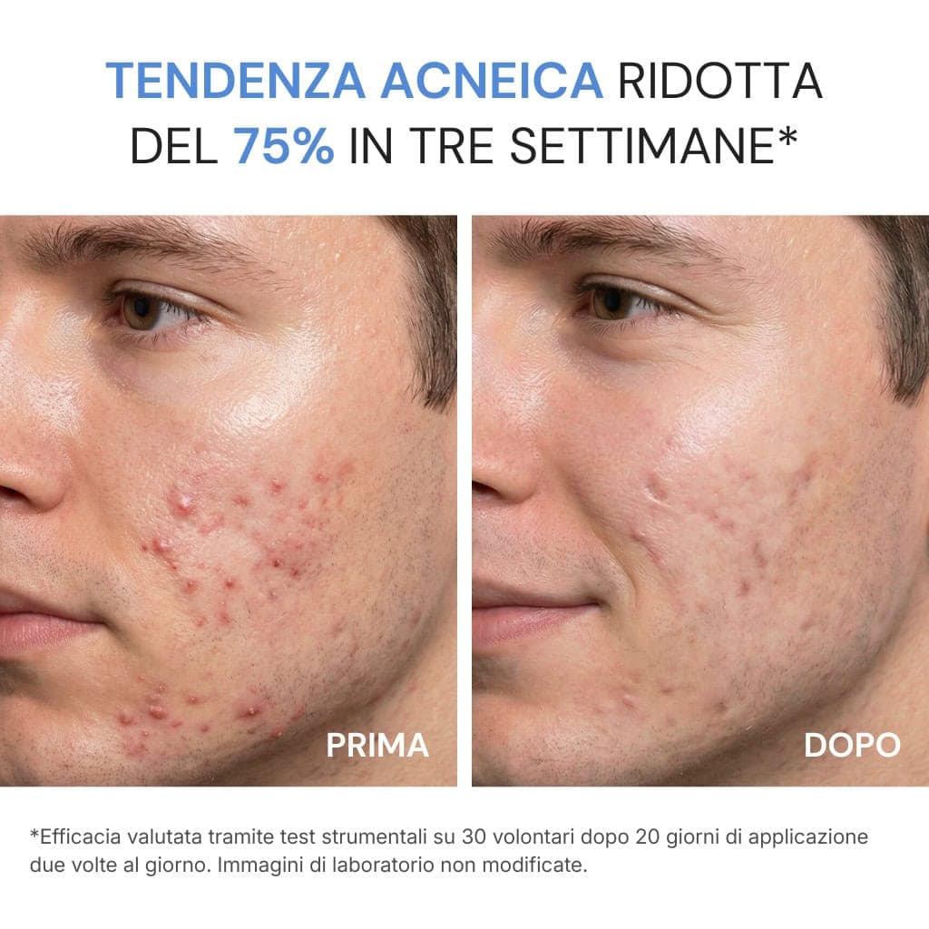 Crema Viso Acne Defense view 2